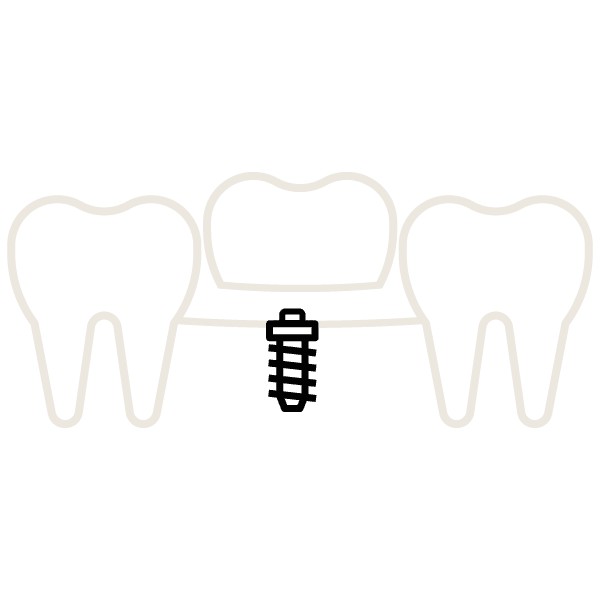 Zahnimplantate Oberursel